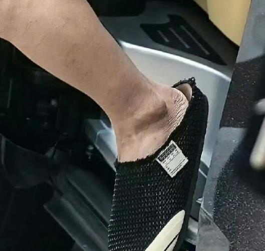 站姐给辛云来磨了脚皮，网友：内娱最卷修图师，连脚皮都修