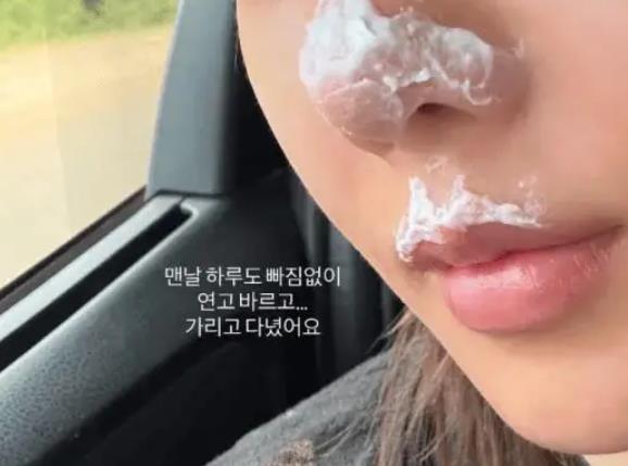 知名女爱豆面部二级烧伤前往医院，公开照片称”出现雀斑且泛红” 